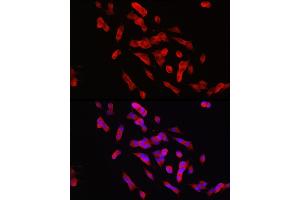 Immunofluorescence analysis of SH-SY5Y cells using PTPN5 Rabbit pAb (ABIN7269705) at dilution of 1:150 (40x lens). (PTPN5 Antikörper  (AA 360-490))