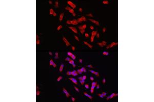 Immunofluorescence analysis of SH-SY5Y cells using PTPN5 Rabbit pAb (ABIN7269705) at dilution of 1:150 (40x lens). (PTPN5 Antikörper  (AA 360-490))