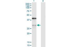 Western Blot analysis of ASPH expression in transfected 293T cell line by ASPH MaxPab polyclonal antibody. (Aspartate beta Hydroxylase Antikörper  (AA 1-270))