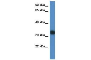 Western Blot showing Gm527 antibody used at a concentration of 1. (GM527 Antikörper  (C-Term))