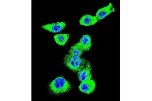 Confocal immunofluorescent analysis of CAV2 Antibody (N-term) (ABIN652586 and ABIN2842393) with MDA-M cell followed by Alexa Fluor 488-conjugated goat anti-rabbit lgG (green). (Caveolin 2 Antikörper  (N-Term))