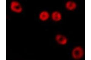 ABIN6277555 staining  HepG2 cells by IF/ICC. (PSMC6 Antikörper  (Internal Region))