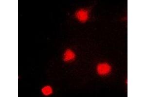 Immunofluorescent analysis of NAT5 staining in A549 cells. (NAT5 Antikörper)