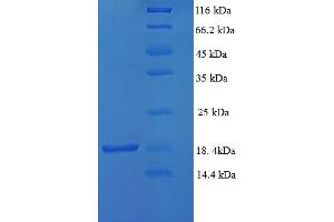 SDS-PAGE (SDS) image for Thymocyte Alloantigen (TTHY) (AA 21-147) protein (His tag) (ABIN5710562) (TTHY Protein (AA 21-147) (His tag))