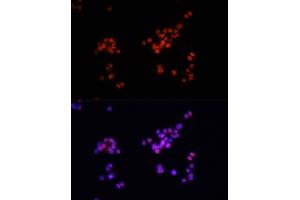 Immunofluorescence analysis of PC-12 cells using Phospho-Smad2-S465/467 + Smad3-S423/425 antibody (ABIN6135314, ABIN6136248, ABIN6136249 and ABIN6225575) at dilution of 1:100. (SMAD2 / SMAD3 (pSer423), (pSer425) Antikörper)