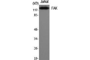 Western Blotting (WB) image for anti-PTK2 Protein tyrosine Kinase 2 (PTK2) (Thr446) antibody (ABIN6285224)