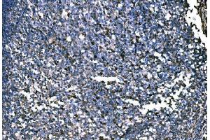 IHC analysis of PKM2 using anti-PKM2 antibody (ABIN3043381). (PKM Antikörper  (N-Term))