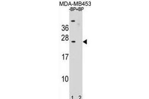 Western blot analysis of SSX6 Antibody (Center) Pab (ABIN1881838 and ABIN2839021) pre-incubated without(lane 1) and with(lane 2) blocking peptide in MDA-M cell line lysate. (SSX6 Antikörper  (AA 62-91))