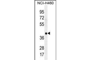 LRRC38 Antibody (C-term) (ABIN655842 and ABIN2845255) western blot analysis in NCI- cell line lysates (35 μg/lane). (LRRC38 Antikörper  (C-Term))