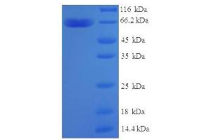 SDS-PAGE (SDS) image for Zinc Finger Protein 114 (ZNF114) (AA 1-414), (partial) protein (His-SUMO Tag) (ABIN5710642) (ZNF114 Protein (AA 1-414, partial) (His-SUMO Tag))
