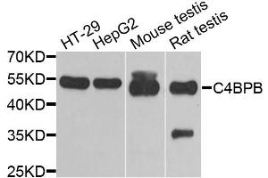Western blot analysis of extracts of various cell lines, using C4BPB antibody. (C4BPB Antikörper)