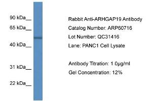 Western Blotting (WB) image for anti-rho GTPase Activating Protein 19 (ARHGAP19) (C-Term) antibody (ABIN2788551)