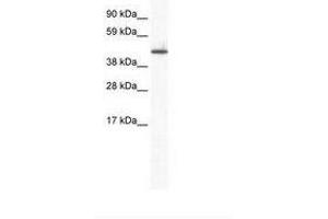 Image no. 1 for anti-Zinc Finger Protein 557 (ZNF557) (AA 298-347) antibody (ABIN6736004) (ZNF557 Antikörper  (AA 298-347))