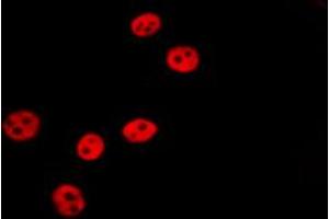 ABIN6267065 staining HepG2 by IF/ICC. (Histone 3 Antikörper  (H3K18ac))