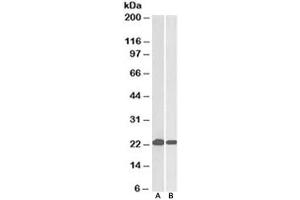 Western blot testing of HeLa [A] and Jurkat [B] lysates with DJ-1 antibody at 0. (PARK7/DJ1 Antikörper)