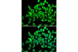 Immunofluorescence analysis of A549 cell using ALS2 antibody.