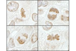 Immunohistochemistry (IHC) image for anti-Kinesin Family Member 2C (KIF2C) (AA 50-100) antibody (ABIN7448647) (KIF2C Antikörper  (AA 50-100))