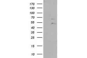 Western Blotting (WB) image for anti-Protein tyrosine Phosphatase, Non-Receptor Type 11 (PTPN11) antibody (ABIN1500499) (PTPN11 Antikörper)