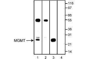 Image no. 2 for anti-O6-Methylguanine-DNA-Methyltransferase (MGMT) antibody (ABIN967567)