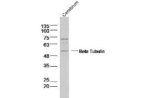 Rat Cerebrum lysates probed with Beta Tubulin Polyclonal Antibody, Unconjugated  at 1:1000 dilution and 4˚C overnight incubation. (TUBB3 Antikörper  (AA 31-130))