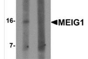 Western blot analysis of MEIG1 in human kidney tissue lysate with MEIG1 antibody at 1 μg/ml in (left) the absence and (right) the presence of blocking peptide. (MEIG1 Antikörper  (C-Term))