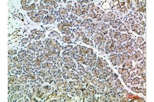 Immunohistochemical analysis of paraffin-embedded human-pancreas, antibody was diluted at 1:200 (MIA2 Antikörper  (AA 361-410))