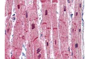 Human Heart: Formalin-Fixed, Paraffin-Embedded (FFPE) (ACTN2 Antikörper)