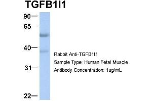 Host:  Rabbit  Target Name:  TGFB1I1  Sample Type:  Human Fetal Muscle  Antibody Dilution:  1. (TGFB1I1 Antikörper  (Middle Region))