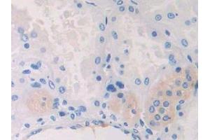 Detection of CAPN2 in Human Kidney Tissue using Polyclonal Antibody to Calpain 2 (CAPN2) (Calpain 2 Antikörper  (AA 45-514))