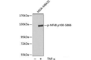 Western blot analysis of extracts of MDA-MB435 cells using Phospho-NFkB p100(S866) Polyclonal Antibody. (NFKB2 Antikörper  (pSer866))