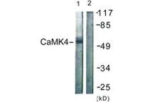 Western blot analysis of extracts from K562 cells, treated with H2O2 100uM 30', using CaMK4 (Ab-196/200) Antibody. (CAMK4 Antikörper  (AA 166-215))