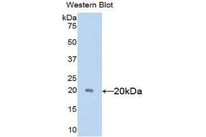 Western Blotting (WB) image for anti-Sex Hormone Binding Globulin (SHBG) (AA 222-358) antibody (ABIN1172841) (SHBG Antikörper  (AA 222-358))