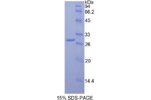 SDS-PAGE analysis of Rat Multimerin 1 Protein.
