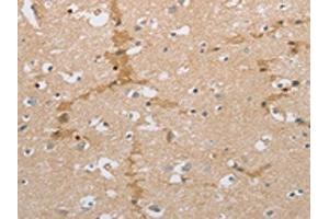 The image on the left is immunohistochemistry of paraffin-embedded Human brain tissue using ABIN7191581(NCAN Antibody) at dilution 1/30, on the right is treated with synthetic peptide. (Neurocan Antikörper)