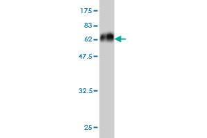 Western Blot detection against Immunogen (59. (MEOX2 Antikörper  (AA 1-303))