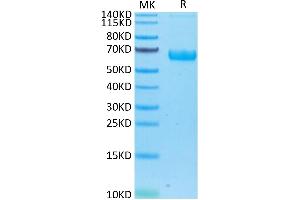 Human/Cynomolgus/Rhesus macaque ROR1 on Tris-Bis PAGE under reduced condition. (ROR1 Protein (AA 30-403) (His-Avi Tag))