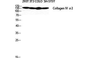 Western Blot (WB) analysis of SH-SY5Y 293T NIH-3T3 COLO205 cells using COL4A2 Polyclonal Antibody. (COL4a2 Antikörper  (N-Term))