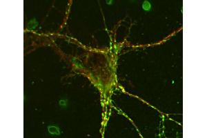 Indirect immunostaining of rat hippocampus neurons with anti-NCAM 180 (dilution 1 : 200; red) and rabbit anti-synapsin 1/2 (, dilution 1 : 500; green).