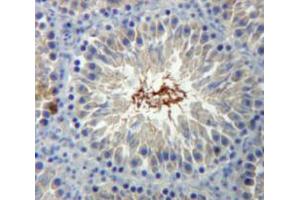 IHC-P analysis of Testis tissue, with DAB staining. (BRCA2 Antikörper  (AA 2913-3151))