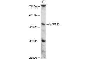 Western blot analysis of extracts of C6 cells, using HCRTR1 antibody (ABIN7267816) at 1:1000 dilution. (HCRTR1 Antikörper  (AA 150-250))