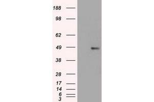 Western Blotting (WB) image for anti-Forkhead Box A1 (FOXA1) (AA 1-473) antibody (ABIN1490773) (FOXA1 Antikörper  (AA 1-473))