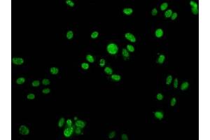 Immunofluorescence staining of HepG2 cells with ABIN7139631 at 1:25, counter-stained with DAPI. (H2AFX Antikörper  (pTyr142))