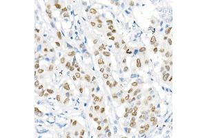 Immunohistochemistry (IHC) image for anti-NK2 Homeobox 1 (NKX2-1) antibody (ABIN1679475)