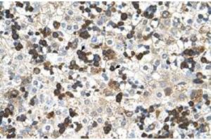 Immunohistochemical staining (Formalin-fixed paraffin-embedded sections) of human liver with HBZ polyclonal antibody  at 4-8 ug/mL working concentration. (HBZ Antikörper  (N-Term))
