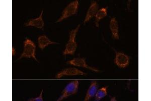 Immunofluorescence analysis of L929 cells using SCGN Polyclonal Antibody at dilution of 1:100. (SCGN Antikörper)
