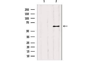 Western blot analysis of extracts from B6F10, using YTHDF2 antibody. (YTHDF2 Antikörper  (Internal Region))