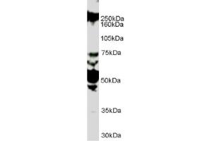 Image no. 1 for anti-Roundabout, Axon Guidance Receptor, Homolog 1 (ROBO1) (Internal Region) antibody (ABIN374636) (ROBO1 Antikörper  (Internal Region))