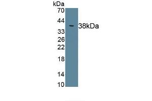 Detection of Recombinant C4, Rat using Polyclonal Antibody to Complement Component 4 (C4) (Complement C4 Antikörper  (AA 1419-1737))