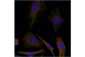 Image no. 3 for anti-Growth Associated Protein 43 (GAP43) (Ser41) antibody (ABIN197546) (GAP43 Antikörper  (Ser41))