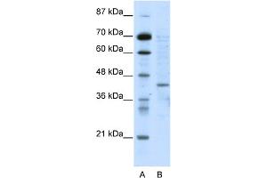 WB Suggested Anti-RING1 Antibody Titration:  5. (RING1 Antikörper  (N-Term))